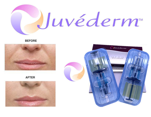 2x1ml十字は表面しわの詰物のためのJuvedermの皮膚注入口をつないだ
