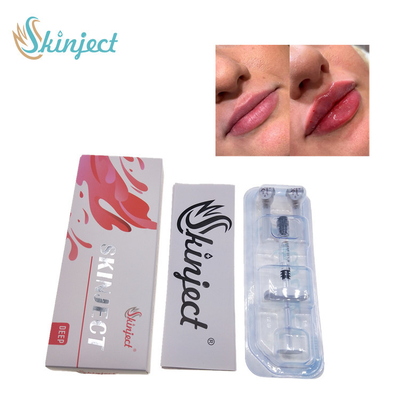 Skinjectの注射可能な深いHyaluronic酸の皮膚2ml唇の注入口