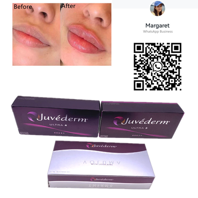 Juvedermの皮膚注入口2x1mlのスポイトの針の十字はゲルの唇の注入をつないだ