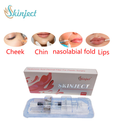 Skinjectの注射可能な深いHyaluronic酸の皮膚2ml唇の注入口
