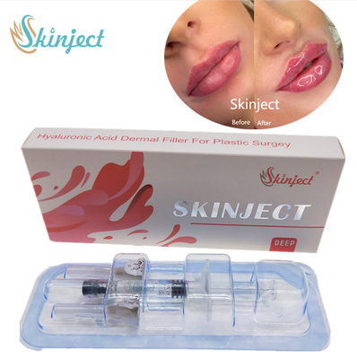 注射可能なSkinject深いHAの皮膚2ml唇の注入口の頬のChinのNasolabial折目