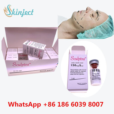 くぼんだ表面を持ち上げるためのの多L乳酸酸PLLAの注入