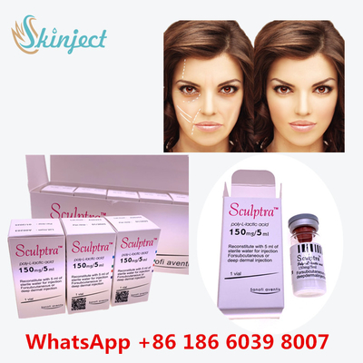 顔に固まることのためのの多L乳酸酸PLLAの注入