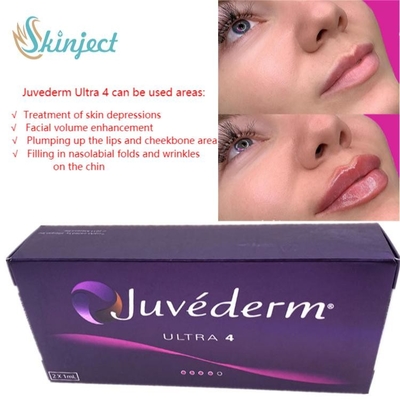 表面心配2x1ml Juvedermの唇の注入口のHyaluronic酸の皮膚注射可能