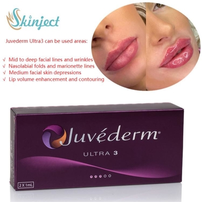 表面心配2x1ml Juvedermの唇の注入口のHyaluronic酸の皮膚注射可能