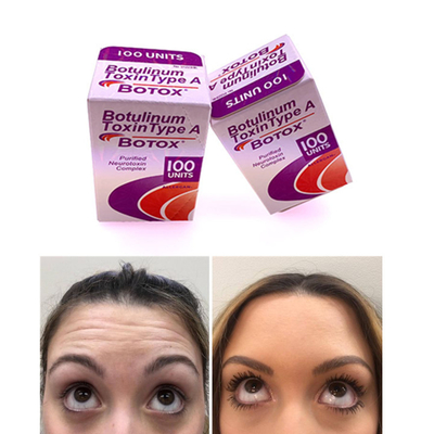 100つのIU Allergan のボツリヌス菌の毒素の英語版