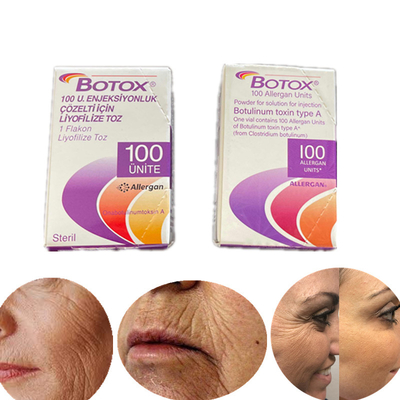 英語版のタイプしわのためのボツリヌス菌の毒素100 Iu Allergan