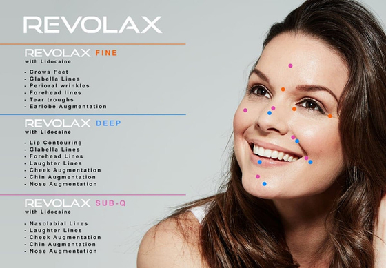 RevolaxのHyaluronic酸の皮膚注入口は唇の増加にしわを寄せる