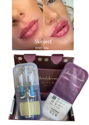 唇はLido Ultra4 2X1mlのJuvedermのHyaluronic酸の皮膚注入口を造り直す