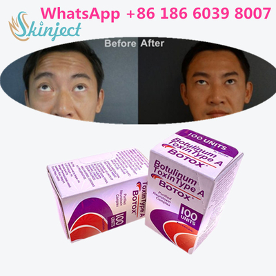 顔のしわのためのボツリヌス菌の毒素Allergan s 1x100iu