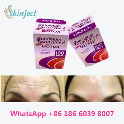 ボツリヌス菌の毒素Allergan は100units 1ガラスびん/箱のパッキングをタイプする