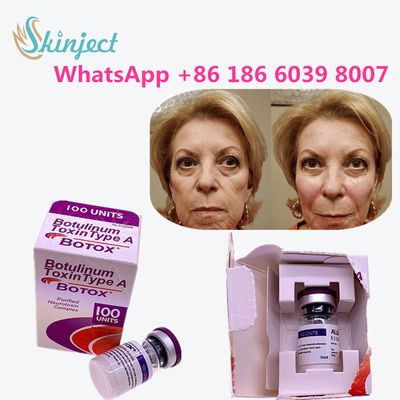 Allergan の皮の反老化するプロダクトのためのボツリヌス菌の毒素のタイプA