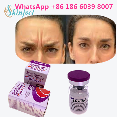 Allergan の皮の反老化するプロダクトのためのボツリヌス菌の毒素のタイプA