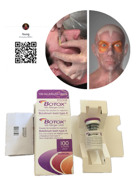 しわのInnotoxs反s Allergan sの皮膚注入口のボツリヌス菌の反しわの取り外しのJuvidermの反年齢