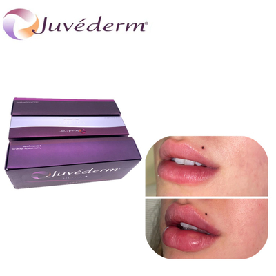 Juvederm ヒアルロン酸 唇拡大 皮膚充填剤 鼻リフティング 顔に耐久性のある充填剤