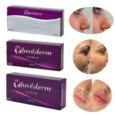Juvederm革命的な注射可能なプロダクト8-12か月のHyaluronic酸の皮膚注入口の