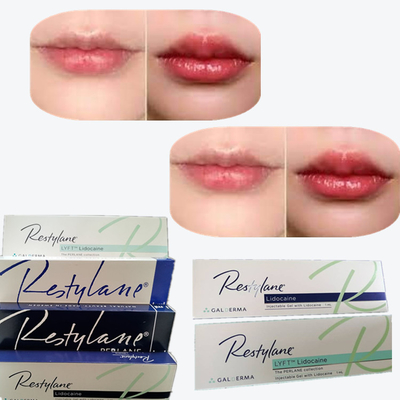 2*1ml/Box 交差リンクされた唇増殖用皮膚フィルラー