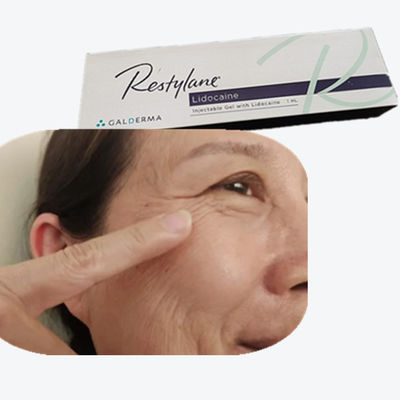 2*1ml/箱 ヒアルロン酸乳房充填剤 HA 額線用皮膚充填剤