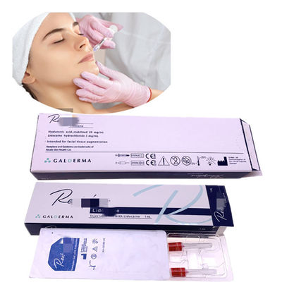 表面、鼻および唇Skinjectのためのしわのヒアルロン酸処置