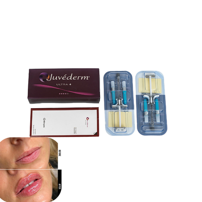 Juvederm 唇の皮膚フィルラー ヒアルロン酸インジェクションフィルラー