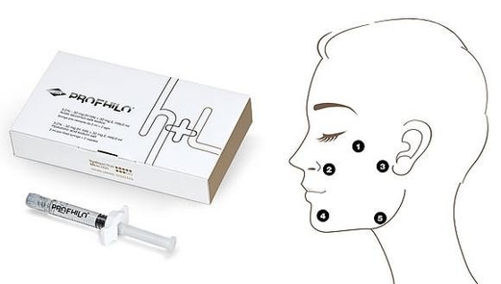 アンチエイジングとシミ除去 プロフィロ H L 2ml ヒアルロン酸 32mg/ml Ha 濃度