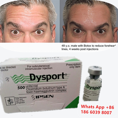 ボツリヌストキシン Dysport Botox クロストリジウム・ボツリヌムA型 眉リフト用