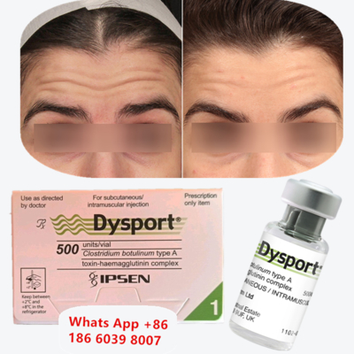 Dysport ボツリヌス毒素A型 しわ治療注射（口周りのライン用）