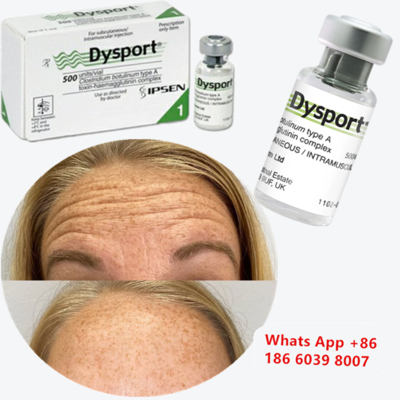 Dysport ボツリヌス毒素A型 しわ治療注射（口周りのライン用）