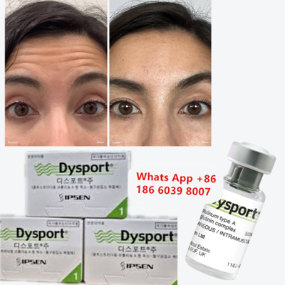 ボツリヌストキシン Dysport しわ防止用凍結乾燥パウダー 小顔効果