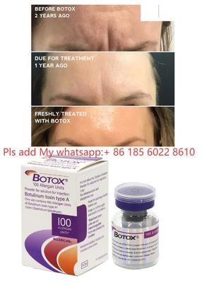 Allergan Botox 100IU Dysport 注射 Botulax ボツリヌス毒素 しわ除去