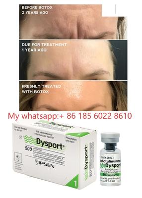 Dysport 500IU 注射 ボツリヌストキシン Allergan ボツラックス - 小じわとシワ