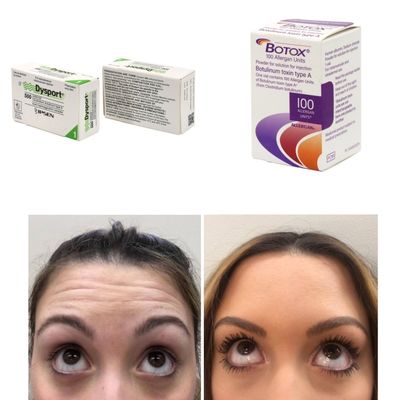 100 ユニット 韓国 BTX 細い線やしわに対するボツリン毒素