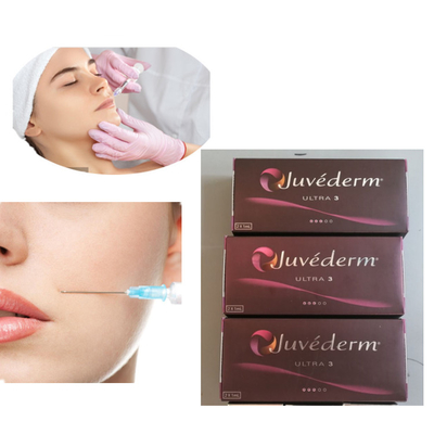 注入Juvederm 2x1ml超3つの唇の皮膚注入口24mg/Ml