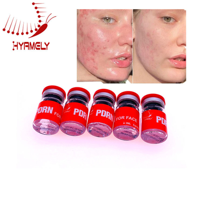 3 Ml Microneedleの注入の皮のブスターPDRNの血清の皮修理
