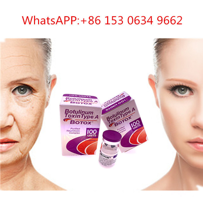 50u 100u 150uのタイプ反しわのためのAllergan の注入のボツリヌス菌の毒素