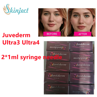 JuvedermのHyaluronic酸のリドカイン2x1ml Ultra3 Ultra4が付いている皮膚注入口のJuvedermの唇の注入口