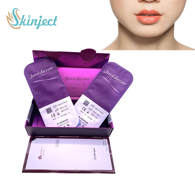 美顔術のための2x1ML Juvederm Ultra3のHyaluronic酸の皮膚注入口