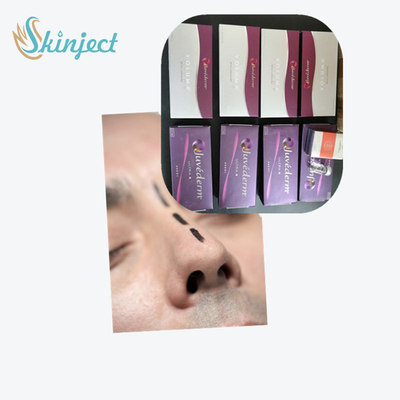 唇のためのHyaluronic酸の皮膚注入口Juvederm Ultra3