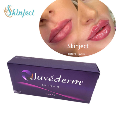Lido Ultra4のJuvederm 2*1mlの唇の注入口のHyaluronic酸の皮膚注入口