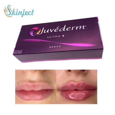 皮膚281ML Hyaluronic酸の唇の注入口Juvederm Ultra3