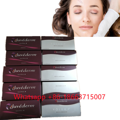 Juvedermの超4 （2x1ml）注射可能な皮膚注入口の唇の拡大