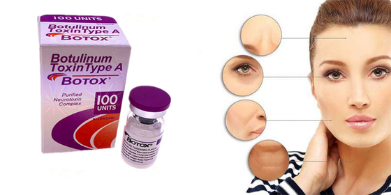 Allerganのボツリヌス菌の毒素のタイプの粉の形態
