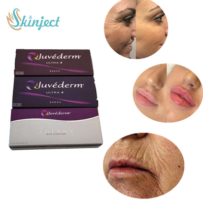 Juvedermセクシーな唇の強化のための超4つの皮膚注入口の唇の注入