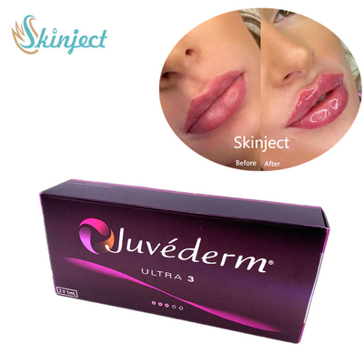 皮膚Juvederm Ultra3 2x1mlのHyaluronic酸の顔の注入口