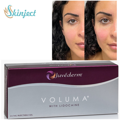 頬骨のChinの輪郭を描くことのためのJuvederm Voluma 2x1ml HAの皮膚注入口
