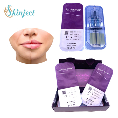 Juvederm Ultra4の唇の拡大の皮膚注入口のHyaluronic酸