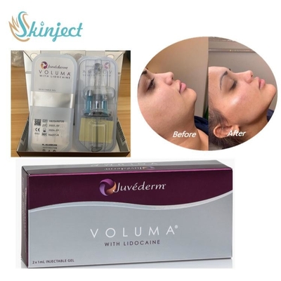 頬のChinの顔の輪郭のためのJuvederm Volumaの皮膚注入口のHyaluronic酸