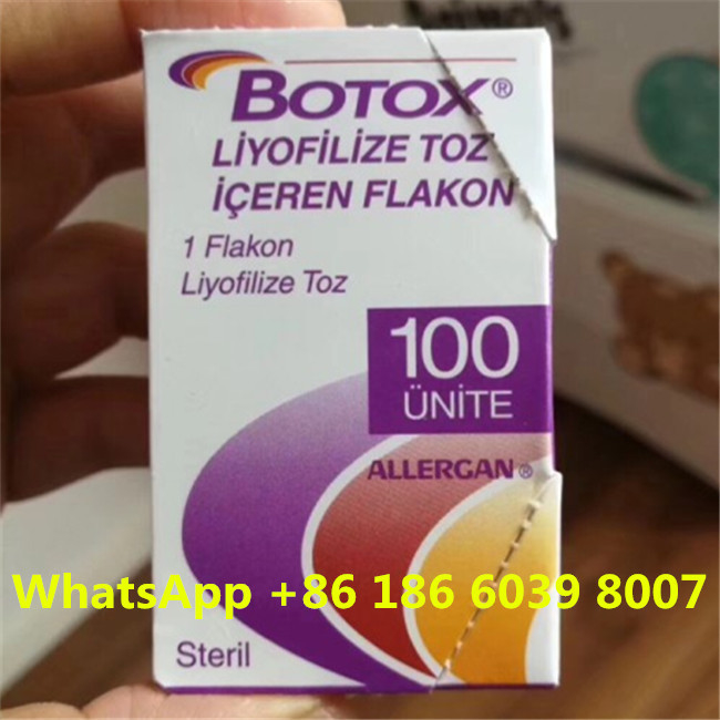 Allerganの注入ののボツリヌス菌の毒素100つの単位のしわの取り外しをタイプするため