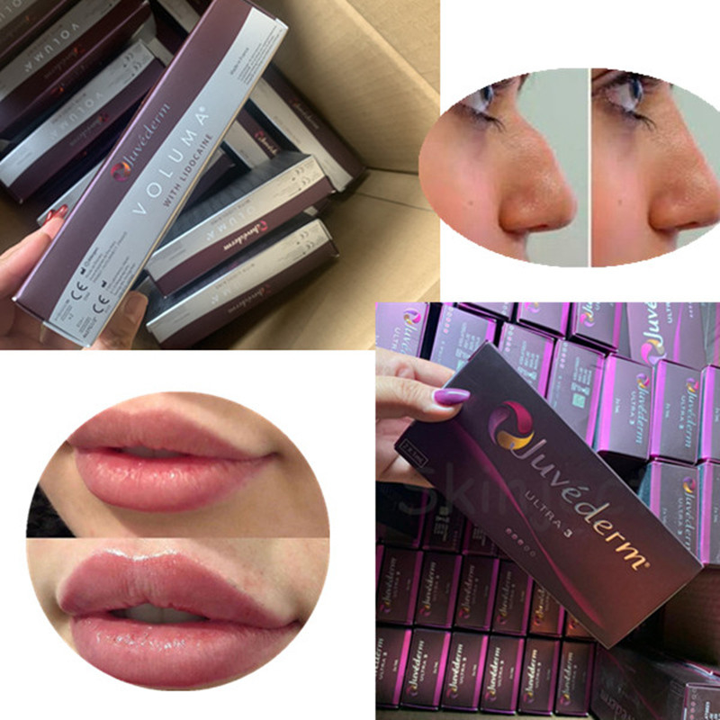 セクシーな唇の強化のための2 ML Juvedermの超4 Hyaluronic酸の皮膚注入口