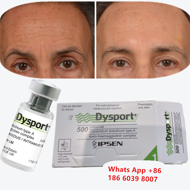 ボツリヌストキシン Dysport Botox アンチリンクル 凍結乾燥粉末 カップルのマンション用